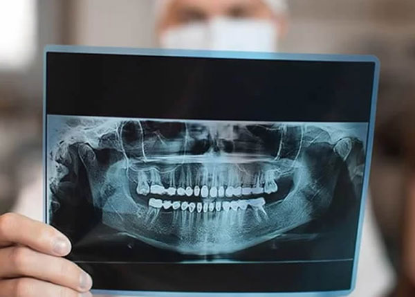 3D Çene (Dental) Tomografisi