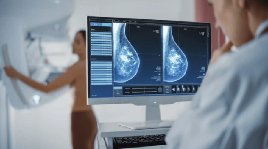 Dijital Mamografi: Erken Teşhisin Gücü